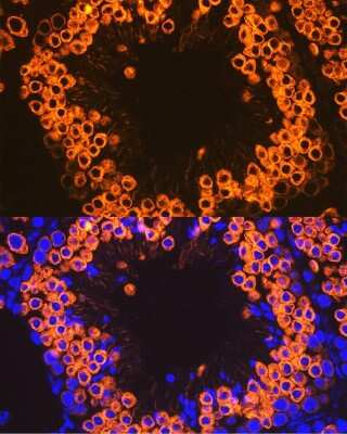 Immunohistochemistry: CLGN Antibody (8R8M1) [NBP3-15833]