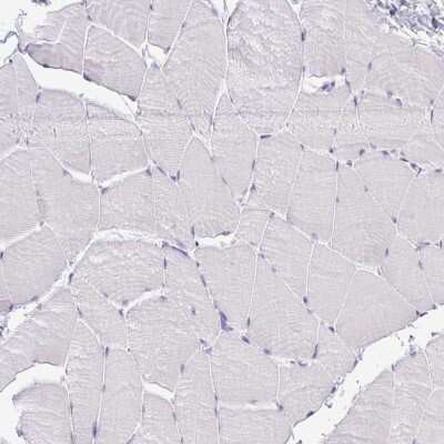 Immunohistochemistry-Paraffin: CLGN Antibody [NBP2-49288]