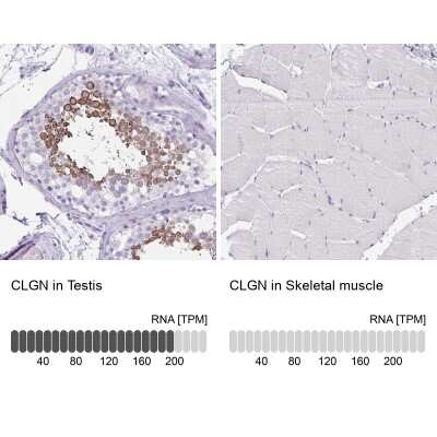 Immunohistochemistry-Paraffin: CLGN Antibody [NBP2-49288]