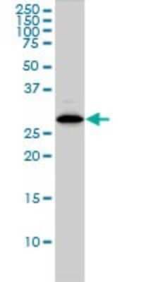 Western Blot: CLIC1 Antibody (2D4) [H00001192-M01]