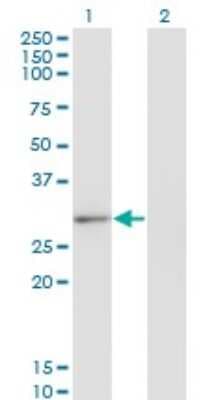 Western Blot: CLIC2 Antibody (2C1) [H00001193-M01]