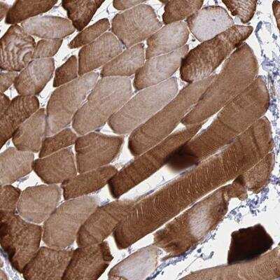Immunohistochemistry-Paraffin: CLIC2 Antibody [NBP2-32516]