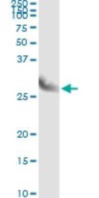 Immunoprecipitation: CLIC3 Antibody (3F8) [H00009022-M02]