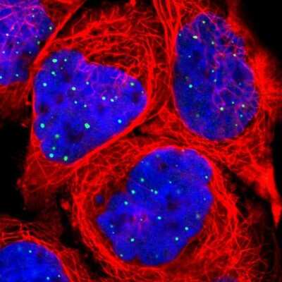 Immunocytochemistry/ Immunofluorescence: CLIC3 Antibody [NBP1-89465]