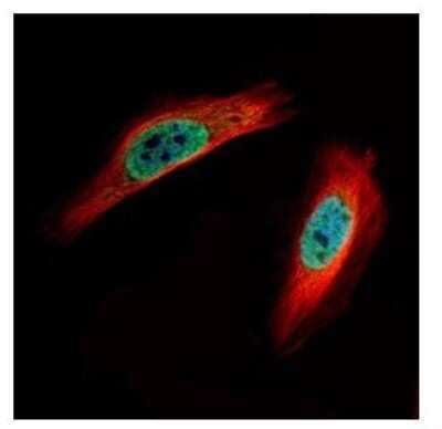 Immunocytochemistry/ Immunofluorescence: CLIC4 Antibody [NBP1-33474]