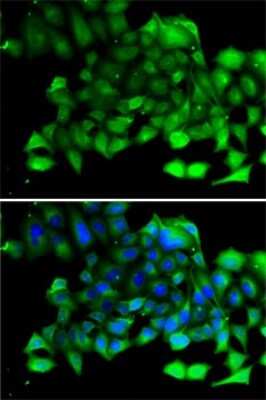 Immunocytochemistry/ Immunofluorescence: CLIC4 Antibody - BSA Free [NBP2-92908]
