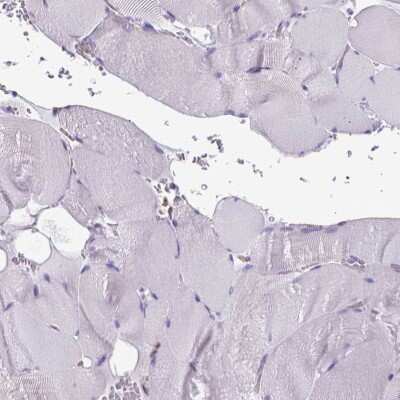 Immunohistochemistry-Paraffin: CLIC4 Antibody [NBP2-49321]
