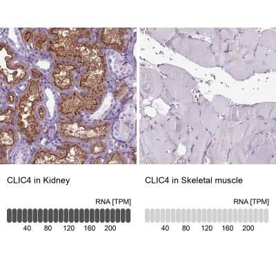 Immunohistochemistry-Paraffin: CLIC4 Antibody [NBP2-49321]