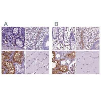 Immunohistochemistry-Paraffin: CLIC4 Antibody [NBP2-49321]