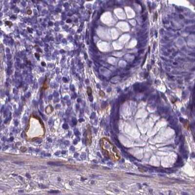 Immunohistochemistry-Paraffin: CLIC4 Antibody [NBP2-49321]