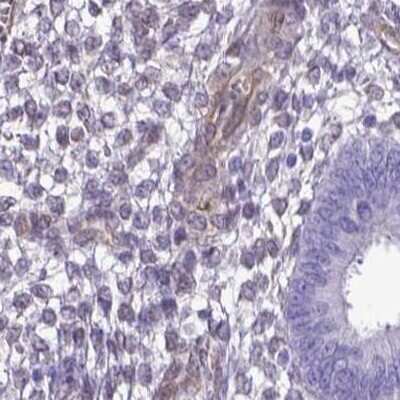 Immunohistochemistry-Paraffin: CLIC4 Antibody [NBP2-49321]