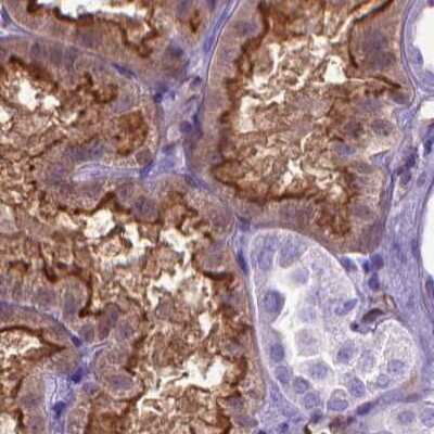 Immunohistochemistry-Paraffin: CLIC4 Antibody [NBP2-49321]