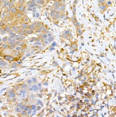 Immunohistochemistry-Paraffin: CLIC4 Antibody - BSA Free [NBP2-92908]