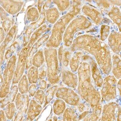 Immunohistochemistry-Paraffin: CLIC4 Antibody - BSA Free [NBP2-92908]