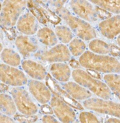 Immunohistochemistry-Paraffin: CLIC4 Antibody - BSA Free [NBP2-92908]