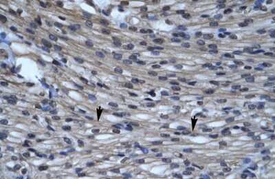 Immunohistochemistry-Paraffin: CLIC5 Antibody [NBP1-80076]
