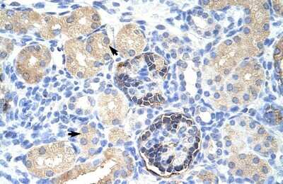 Immunohistochemistry-Paraffin: CLIC5 Antibody [NBP1-80077]