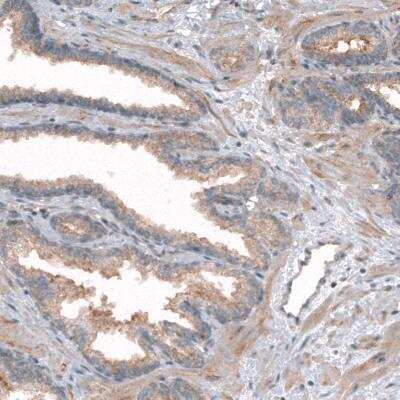 Immunohistochemistry-Paraffin: CLIP170 Antibody (CL4844) [NBP2-61143]