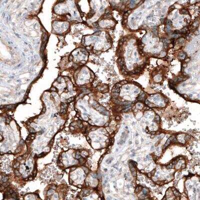 Immunohistochemistry-Paraffin: CLIP170 Antibody (CL4844) [NBP2-61143]