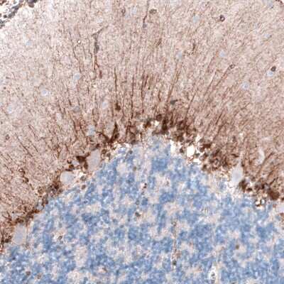 Immunohistochemistry-Paraffin: CLIP170 Antibody (CL4851) [NBP2-61144]