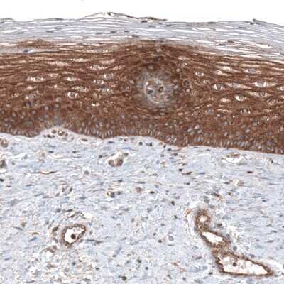 Immunohistochemistry-Paraffin: CLIP170 Antibody (CL4851) [NBP2-61144]