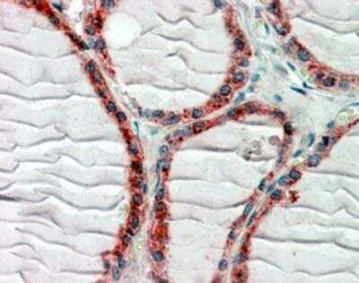 Immunohistochemistry-Paraffin: CLIP170 Antibody [NBP1-36749]