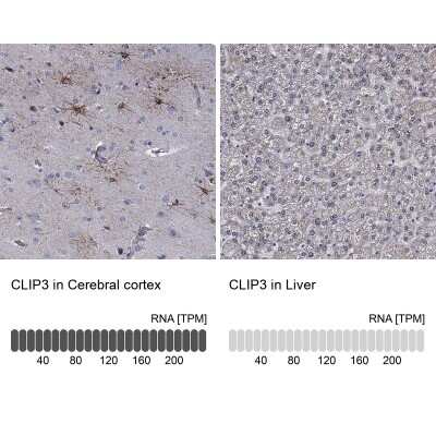 Immunohistochemistry-Paraffin: CLIP3 Antibody [NBP3-17101]