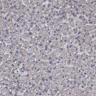 Immunohistochemistry-Paraffin: CLIP3 Antibody [NBP3-17101]