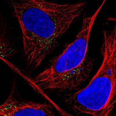 Immunocytochemistry/ Immunofluorescence: CLIP4 Antibody [NBP1-91793]