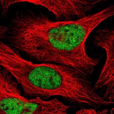 Immunocytochemistry/ Immunofluorescence: CLK2 Antibody [NBP2-47506]
