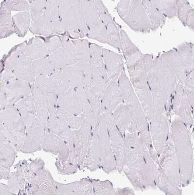 Immunohistochemistry-Paraffin: CLK2 Antibody [NBP2-47506]