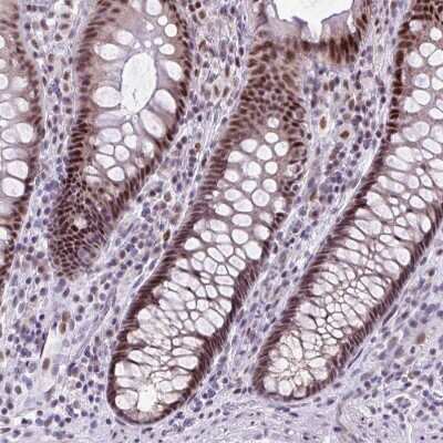 Immunohistochemistry-Paraffin: CLK2 Antibody [NBP2-47506]