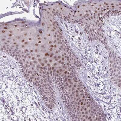 Immunohistochemistry-Paraffin: CLK2 Antibody [NBP2-47506]