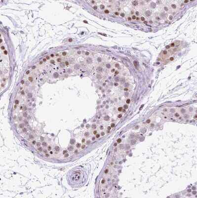 Immunohistochemistry-Paraffin: CLK2 Antibody [NBP2-47506]