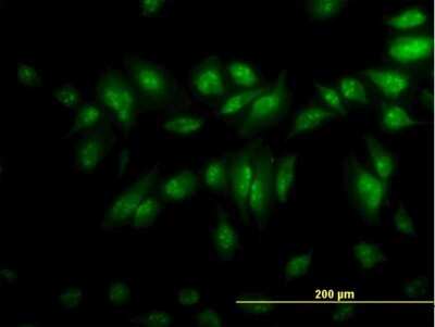 Immunocytochemistry/ Immunofluorescence: CLK3 Antibody (1F10) [H00001198-M05]