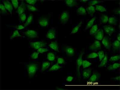 Immunocytochemistry/ Immunofluorescence: CLK3 Antibody (5B2) [H00001198-M04]