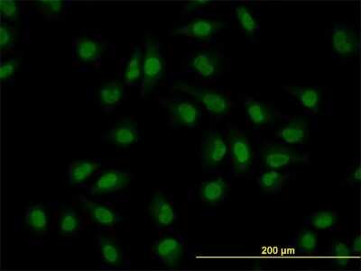 Immunocytochemistry/ Immunofluorescence: CLK3 Antibody (7D6) [H00001198-M07]
