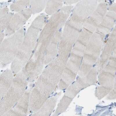 Immunohistochemistry-Paraffin: CLMN Antibody [NBP1-94034]