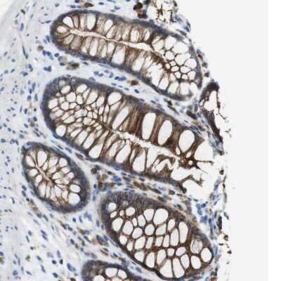 Immunohistochemistry-Paraffin: CLMN Antibody [NBP1-94034]