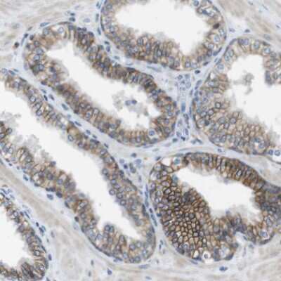 Immunohistochemistry-Paraffin: CLMN Antibody [NBP1-94034]