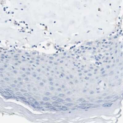 Immunohistochemistry-Paraffin: CLMN Antibody [NBP1-94034]