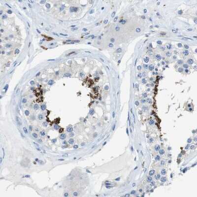 Immunohistochemistry-Paraffin: CLMN Antibody [NBP1-94034]
