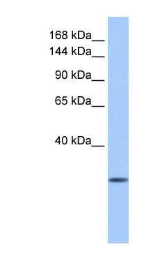 Western Blot: CLMN Antibody [NBP1-91449]