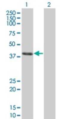 Western Blot: CLN3 Antibody (1G10) [H00001201-M03]