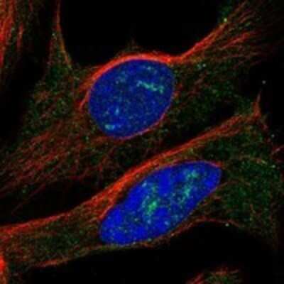 Immunocytochemistry/ Immunofluorescence: CLN6 Antibody [NBP3-17819]
