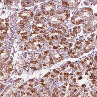 Immunohistochemistry-Paraffin: CLN6 Antibody [NBP2-39066]
