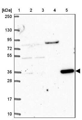 Western Blot: CLN6 Antibody [NBP2-39066]