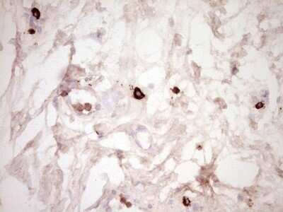 Immunohistochemistry: CLOCK Antibody (OTI2H7) [NBP2-46311]