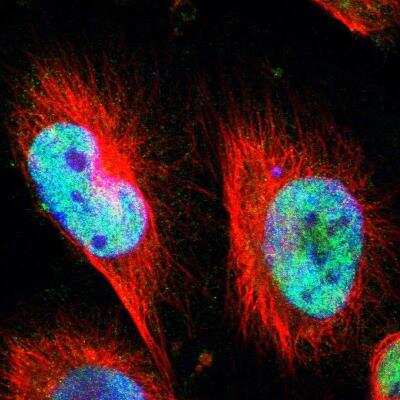 Immunocytochemistry/ Immunofluorescence: CLOCK Antibody [NBP1-88615]