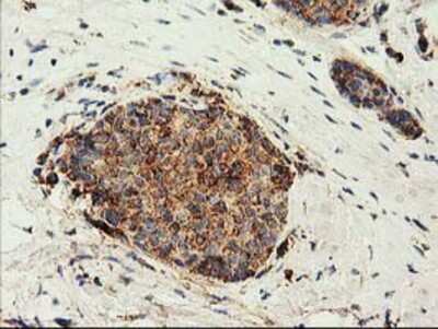 Immunohistochemistry-Paraffin: CLPP Antibody (OTI1F6) [NBP2-03323]